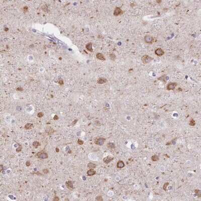 Immunohistochemistry-Paraffin: MAP1A Antibody [NBP1-82801]