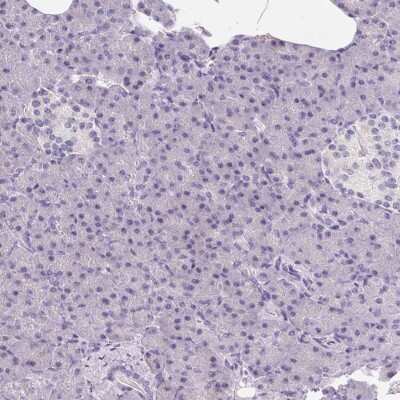Immunohistochemistry-Paraffin: MAP1A Antibody [NBP1-82801]