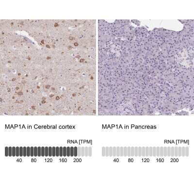 Immunohistochemistry-Paraffin: MAP1A Antibody [NBP1-82801]