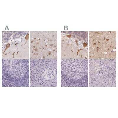 Immunohistochemistry-Paraffin: MAP1A Antibody [NBP1-82801]