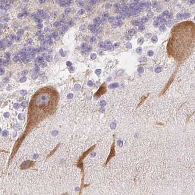 Immunohistochemistry-Paraffin: MAP1A Antibody [NBP1-82801]
