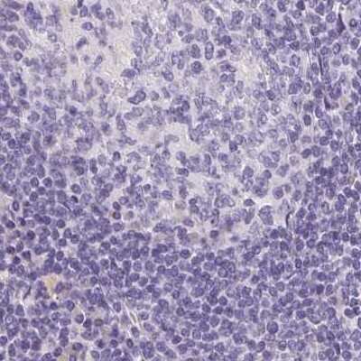 Immunohistochemistry-Paraffin: MAP1A Antibody [NBP1-82801]