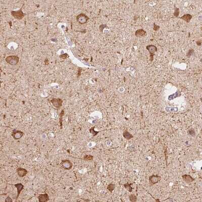 Immunohistochemistry-Paraffin: MAP1A Antibody [NBP2-32630]