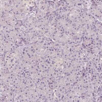 Immunohistochemistry-Paraffin: MAP1A Antibody [NBP2-32630]