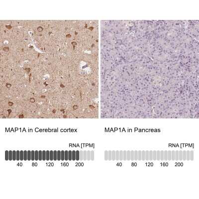 Immunohistochemistry-Paraffin: MAP1A Antibody [NBP2-32630]