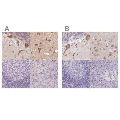 Immunohistochemistry-Paraffin: MAP1A Antibody [NBP2-32630]