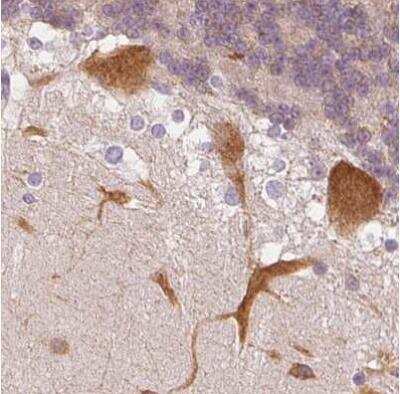 Immunohistochemistry-Paraffin: MAP1A Antibody [NBP2-32630]