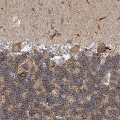 Immunohistochemistry-Paraffin: MAP1B Antibody [NBP1-81261]