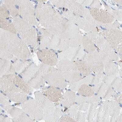 Immunohistochemistry-Paraffin: MAP1B Antibody [NBP1-81261]