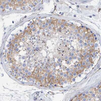 Immunohistochemistry-Paraffin: MAP1B Antibody [NBP1-81261]