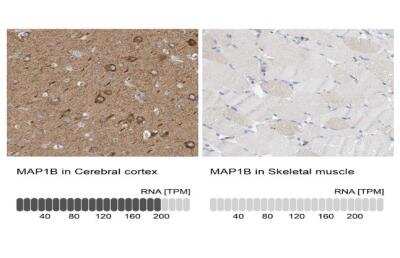 Immunohistochemistry-Paraffin: MAP1B Antibody [NBP1-81261]