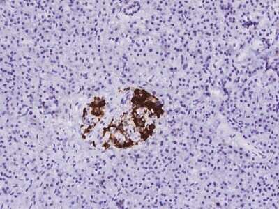 Immunohistochemistry-Paraffin: MAP1B Antibody [NBP3-06024]