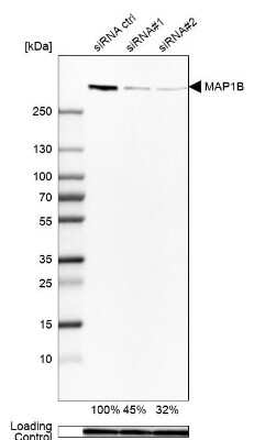 Western Blot: MAP1B Antibody [NBP1-81261]