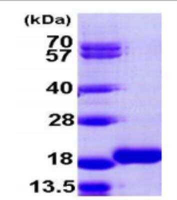 SDS-PAGE: Recombinant Human LC3B2 His Protein [NBP1-99115]