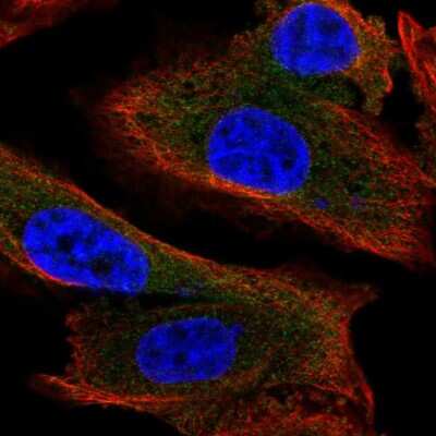 Immunocytochemistry/ Immunofluorescence: MAP1S Antibody [NBP2-47383]