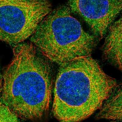 Immunocytochemistry/ Immunofluorescence: MAP1S Antibody [NBP2-48987]