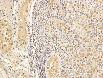 Immunohistochemistry-Paraffin: MAP1S Antibody [NBP1-47281]