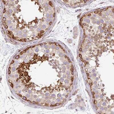 Immunohistochemistry-Paraffin: MAP1S Antibody [NBP2-47383]