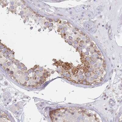 Immunohistochemistry-Paraffin: MAP1S Antibody [NBP2-48987]