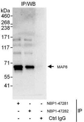 Immunoprecipitation: MAP1S Antibody [NBP1-47282]