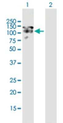 Western Blot: MAP1S Antibody [H00055201-B01P]