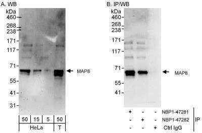 Western Blot: MAP1S Antibody [NBP1-47281]