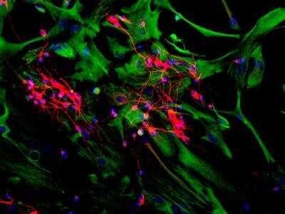 Immunocytochemistry/ Immunofluorescence: MAP2 Antibody (2C4) [NBP2-50032]