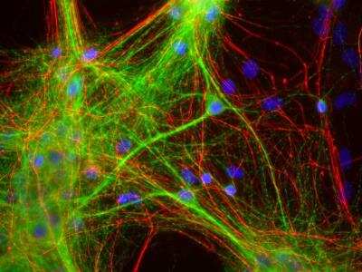 Immunocytochemistry/ Immunofluorescence: MAP2 Antibody (4H5) [NBP2-25156]