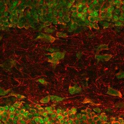 Immunohistochemistry-Paraffin: MAP2 Antibody (4H5) [NBP2-25156]