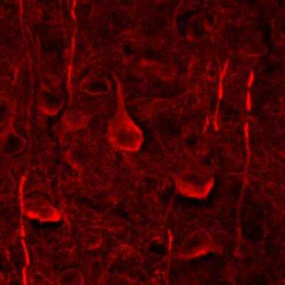 Immunohistochemistry-Paraffin: MAP2 Antibody (4H5) [NBP2-25156]