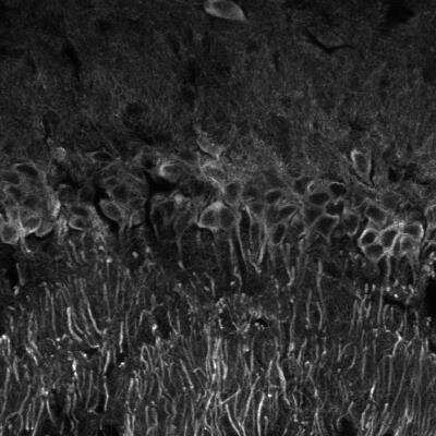 Immunohistochemistry-Paraffin: MAP2 Antibody (4H5) [NBP2-25156]
