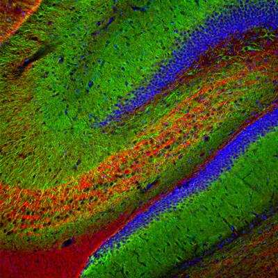 Immunohistochemistry Free-Floating: MAP2 Antibody (5H11) [NBP1-92711]