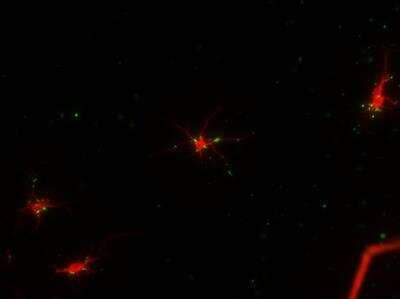 Immunocytochemistry/ Immunofluorescence: MAP2 Antibody (5H11) [NBP1-92711]