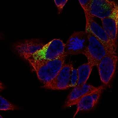 Immunocytochemistry/ Immunofluorescence: MAP2 Antibody (CL5420) [NBP2-61417]