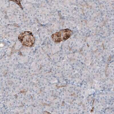 Immunohistochemistry-Paraffin: MAP2 Antibody (CL5420) [NBP2-61417]