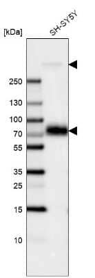 Western Blot: MAP2 Antibody (CL5420) [NBP2-61417]