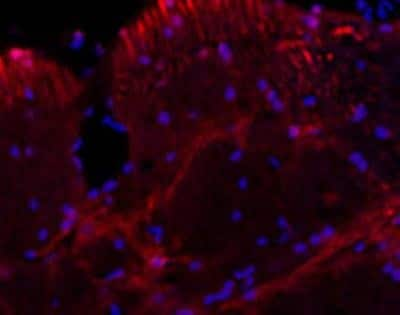 Immunocytochemistry/ Immunofluorescence: MAP2 Antibody [NB100-98717]