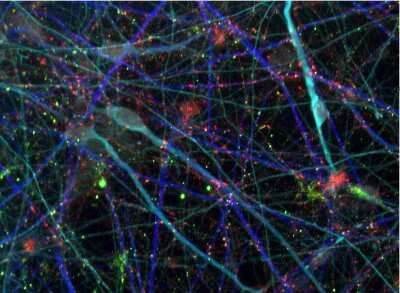 Immunocytochemistry/Immunofluorescence Staining of MAP2 in Human DA Neurons