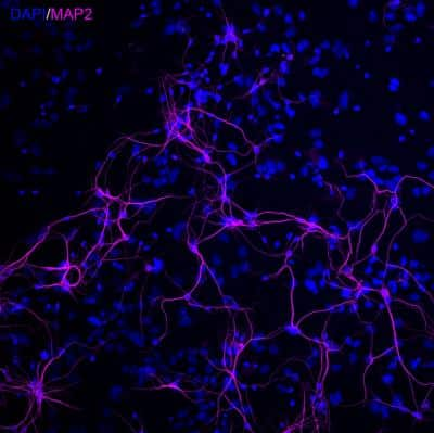 Immunocytochemistry/Immunofluorescence Staining of MAP2 in Mouse Primary Cultures