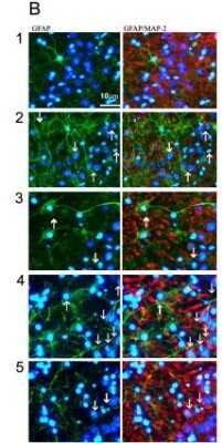 Immunofluorescent Analysis of MAP2 in Treated Rat Hippocampi