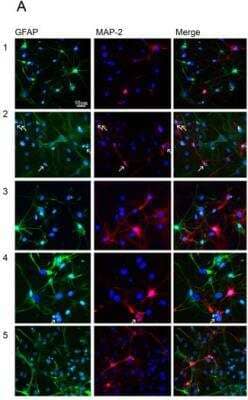 Immunocytochemistry/Immunofluorescence Staining of MAP2 in Astrocyte/Neuron Mixed Cultures