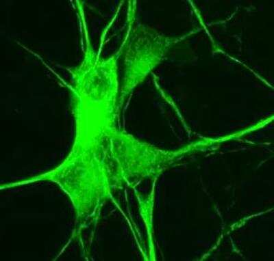 Immunocytochemistry/Immunofluorescence Staining of MAP2 in Human iPS Derived Neurons