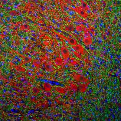 Immunocytochemistry/ Immunofluorescence: MAP2 Antibody [NBP3-05552]