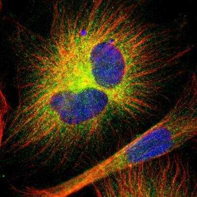 Immunofluorescence: MAP2 Antibody [NBP1-81264]