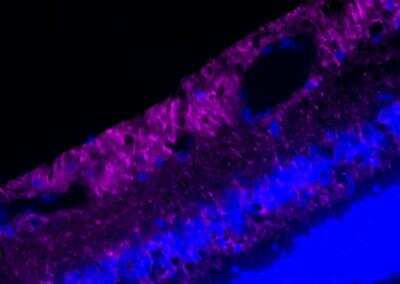 Immunohistochemical Analysis of MAP2 in Frozen Retina