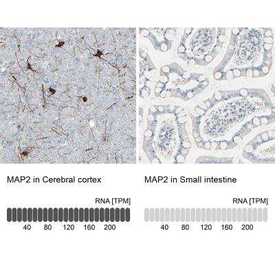 Immunohistochemistry: MAP2 Antibody [NBP1-81264]