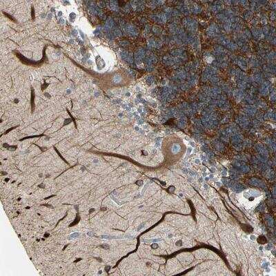 Immunohistochemistry: MAP2 Antibody [NBP1-81264]