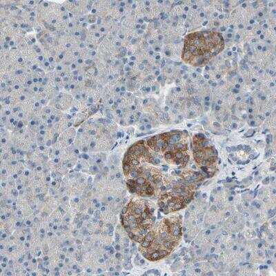 Immunohistochemistry: MAP2 Antibody [NBP1-81264]