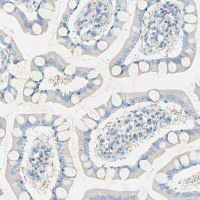 Immunohistochemistry: MAP2 Antibody [NBP1-81264]