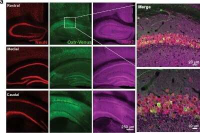 Immunohistochemical Staining of MAP2 in Paraffin Embedded Mouse Hippocampus